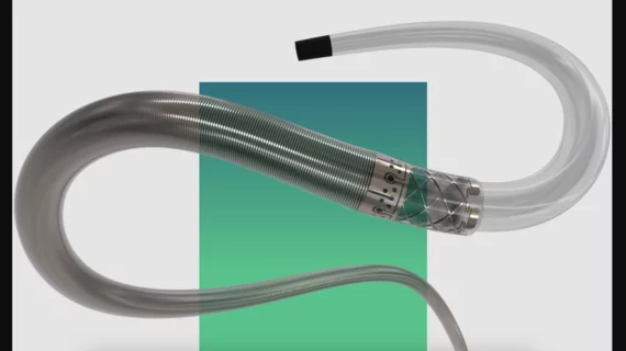 072 Aspiration System