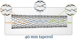 Xact Rapid Exchange Carotid Stent System